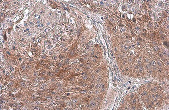 TSG101 Antibody in Immunohistochemistry (Paraffin) (IHC (P))