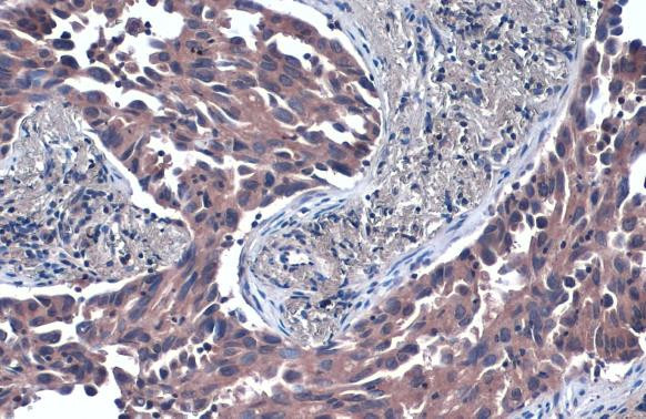 TSG101 Antibody in Immunohistochemistry (Paraffin) (IHC (P))