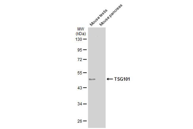 TSG101 Antibody in Western Blot (WB)