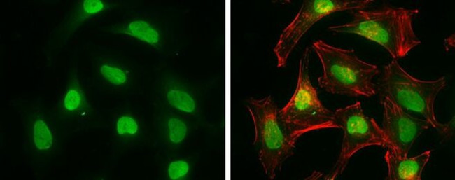 CtIP Antibody in Immunocytochemistry (ICC/IF)