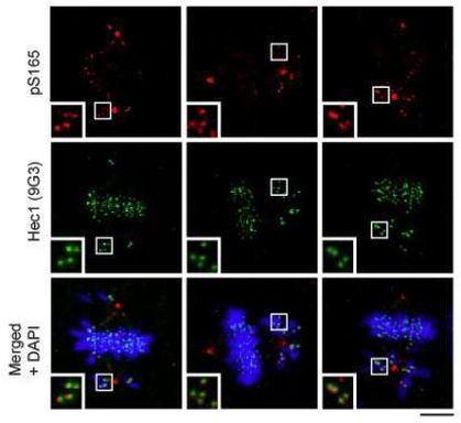 HEC1 Antibody in Immunocytochemistry (ICC/IF)