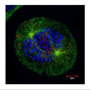 HEC1 Antibody in Immunocytochemistry (ICC/IF)