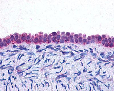 C/EBP beta Antibody in Immunohistochemistry (IHC)