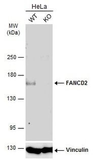 FANCD2 Antibody