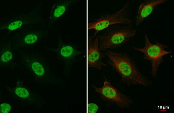 FANCD2 Antibody in Immunocytochemistry (ICC/IF)