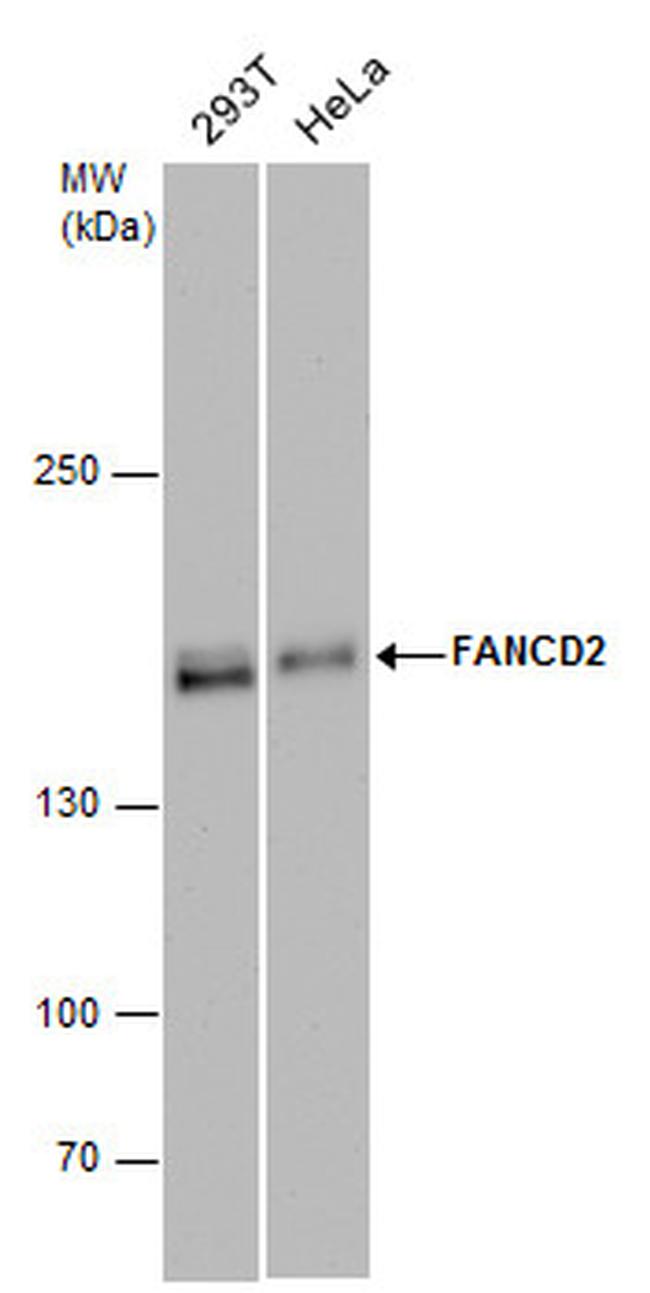 FANCD2 Antibody in Western Blot (WB)