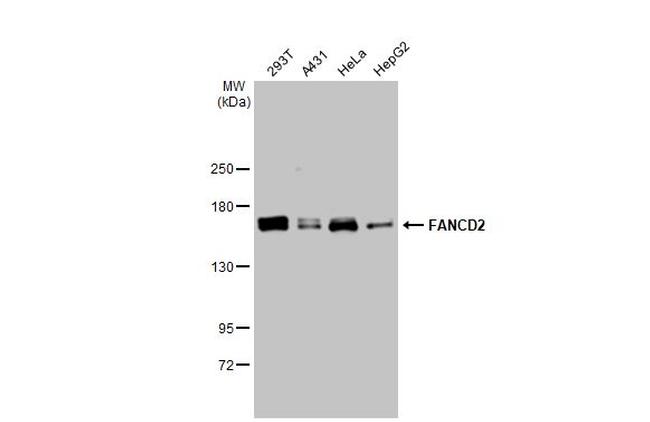 FANCD2 Antibody in Western Blot (WB)