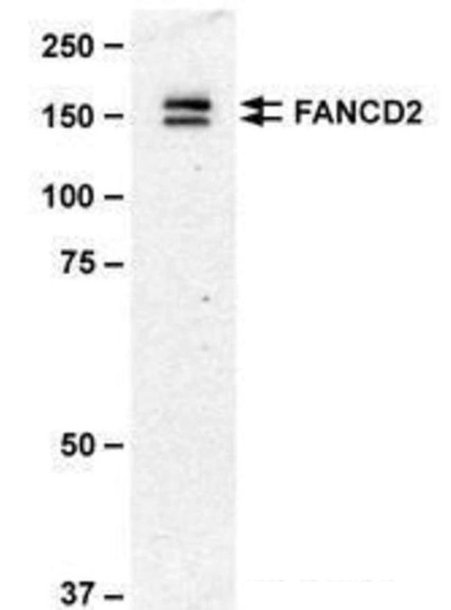 FANCD2 Antibody in Western Blot (WB)