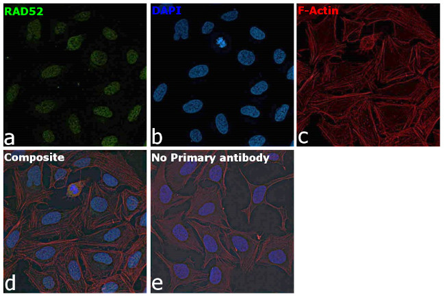 RAD52 Antibody in Immunocytochemistry (ICC/IF)