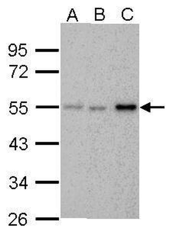 Chk1 Antibody in Western Blot (WB)