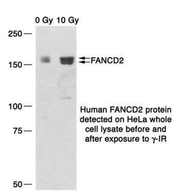 FANCD2 Antibody in Western Blot (WB)