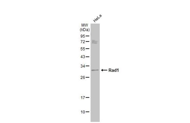 RAD1 Antibody in Western Blot (WB)