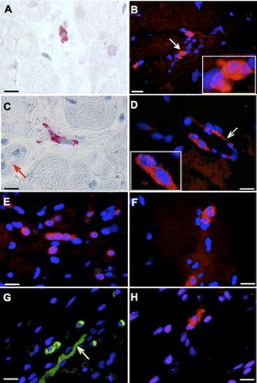 Tyrosine Hydroxylase Antibody in Immunohistochemistry (IHC)