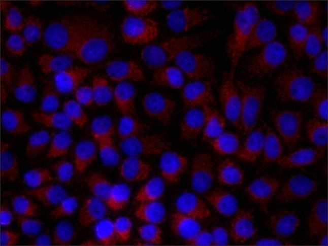 Paxillin Antibody in Immunocytochemistry (ICC/IF)