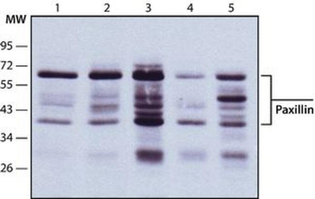 Paxillin Antibody in Western Blot (WB)