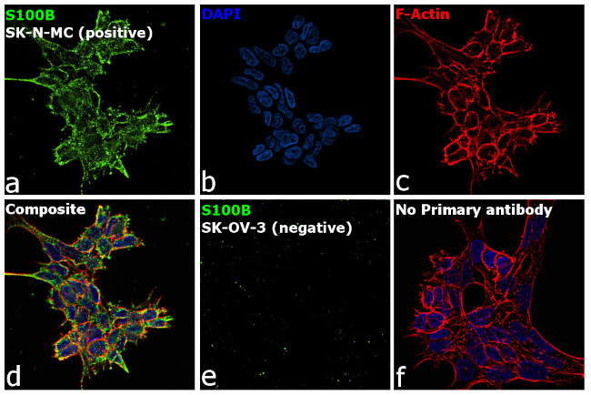 S100B Antibody in Immunocytochemistry (ICC/IF)