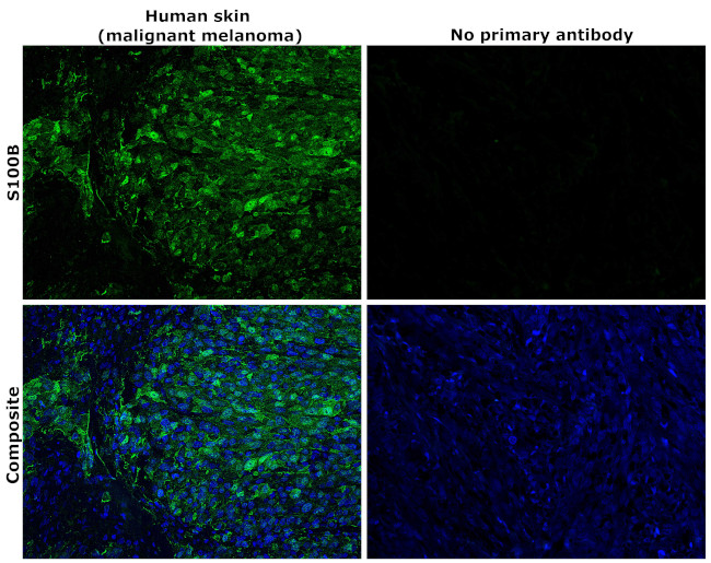 S100B Antibody in Immunohistochemistry (Paraffin) (IHC (P))