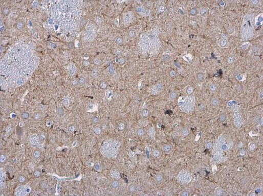 MAP2 Antibody in Immunohistochemistry (Paraffin) (IHC (P))