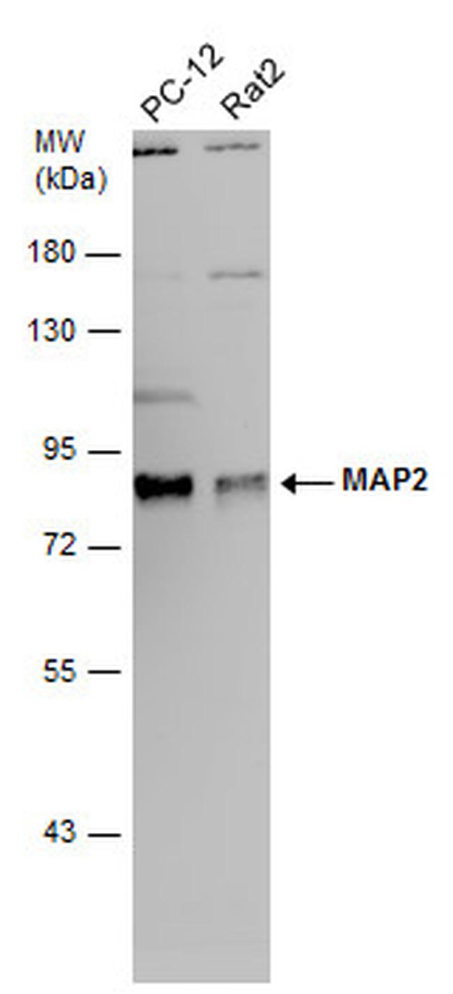 MAP2 Antibody in Western Blot (WB)