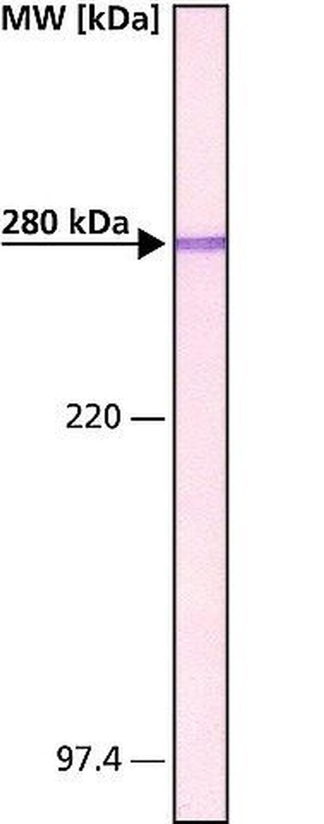 MAP2 Antibody in Western Blot (WB)