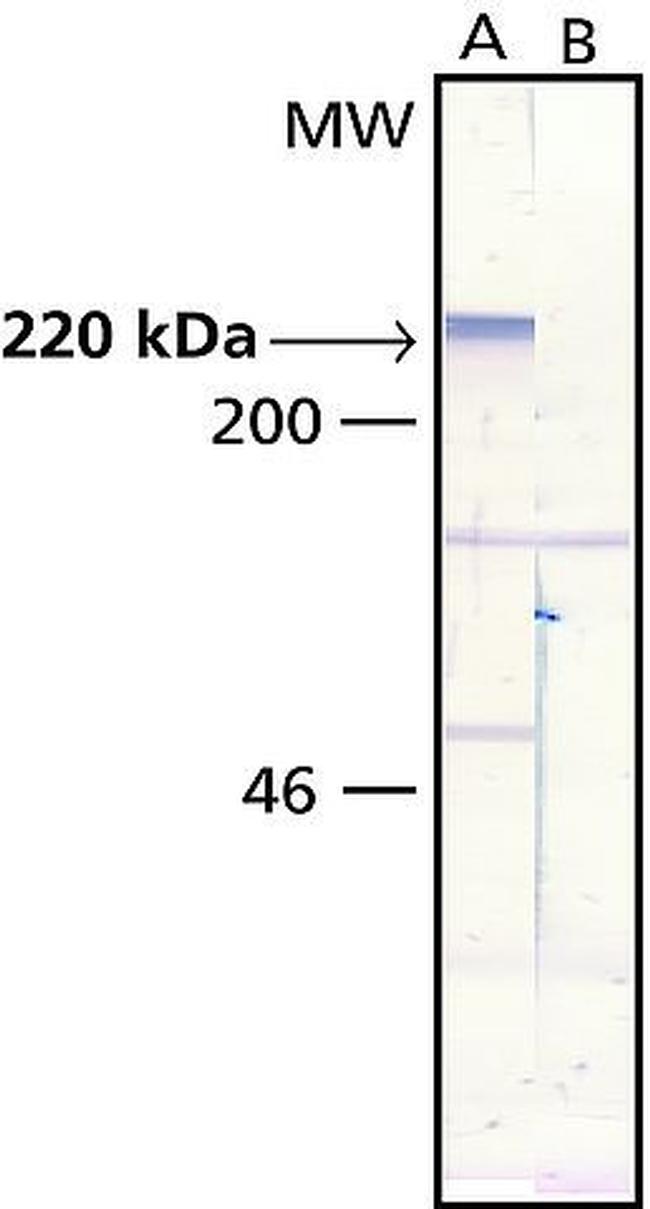 MAP2 Antibody in Western Blot (WB)