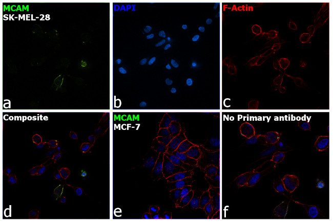 CD146 Antibody in Immunocytochemistry (ICC/IF)