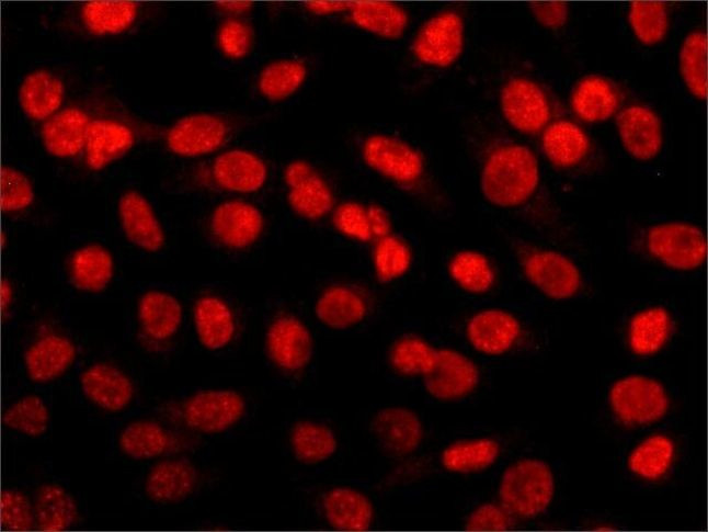 HDAC2 Antibody in Immunocytochemistry (ICC/IF)