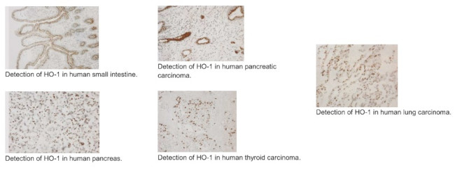 HMOX1 Antibody in Immunohistochemistry (Paraffin) (IHC (P))