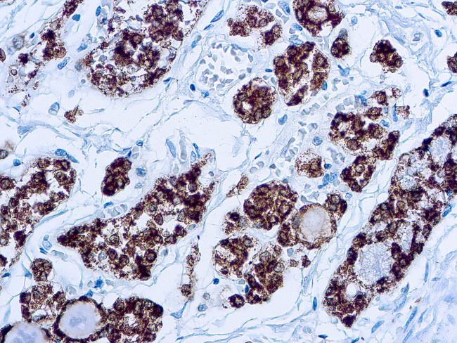 Thyroid Peroxidase Antibody in Immunohistochemistry (Paraffin) (IHC (P))