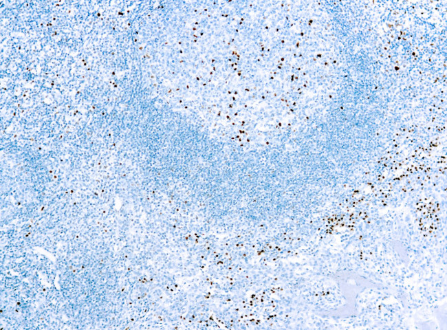 IRF4 Antibody in Immunohistochemistry (Paraffin) (IHC (P))