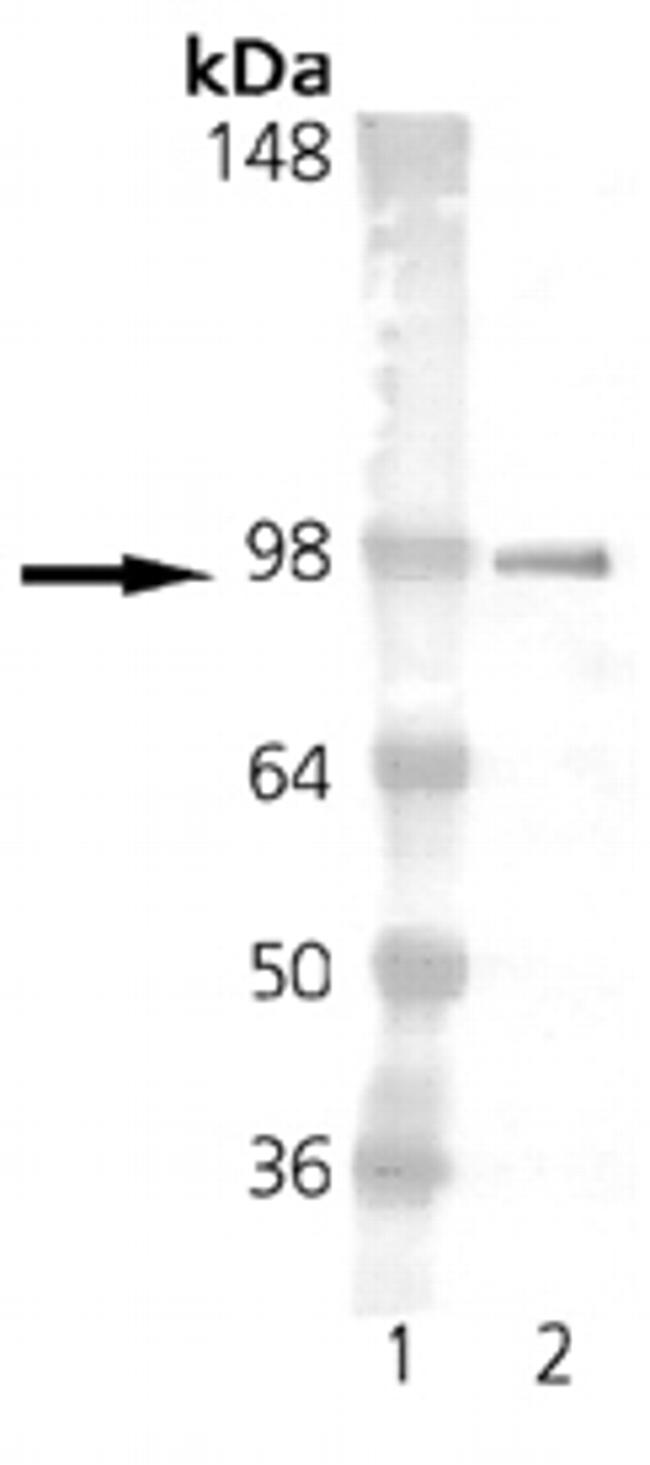 Estrogen Receptor alpha Antibody in Western Blot (WB)