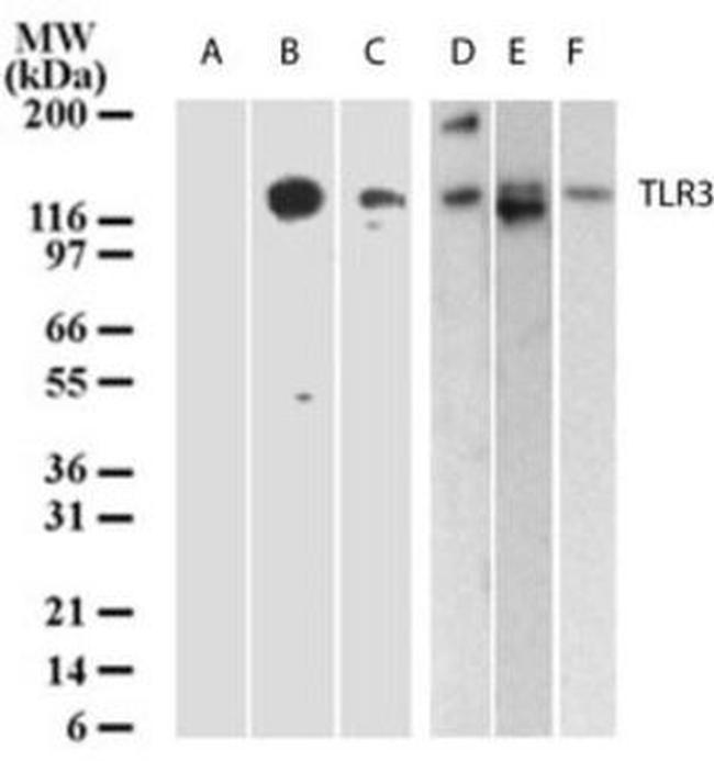 TLR3 Antibody in Western Blot (WB)