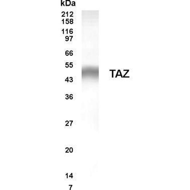 G-CSF Antibody in Western Blot (WB)