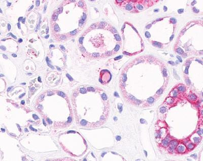 Collagen V Antibody in Immunohistochemistry (IHC)