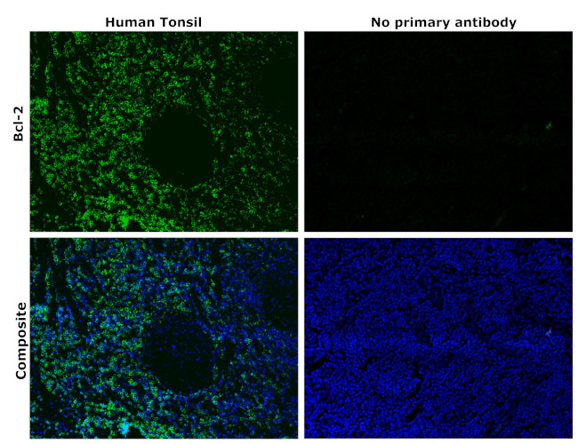 Bcl-2 Antibody in Immunohistochemistry (Paraffin) (IHC (P))