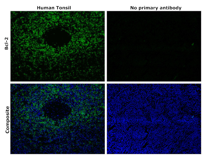 Bcl-2 Antibody in Immunohistochemistry (Paraffin) (IHC (P))