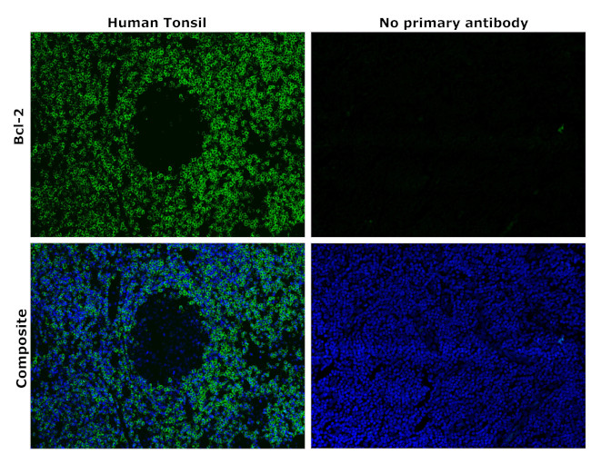 Bcl-2 Antibody in Immunohistochemistry (Paraffin) (IHC (P))