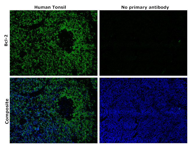 Bcl-2 Antibody in Immunohistochemistry (Paraffin) (IHC (P))