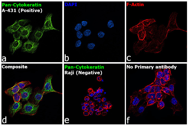 Cytokeratin Pan Antibody in Immunocytochemistry (ICC/IF)