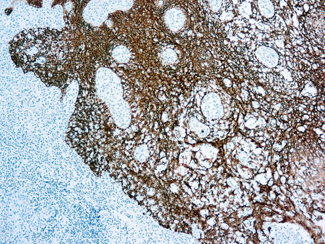 Cytokeratin Pan Antibody in Immunohistochemistry (Paraffin) (IHC (P))