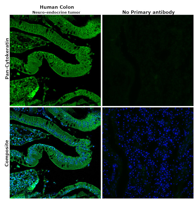 Cytokeratin Pan Antibody in Immunohistochemistry (Paraffin) (IHC (P))