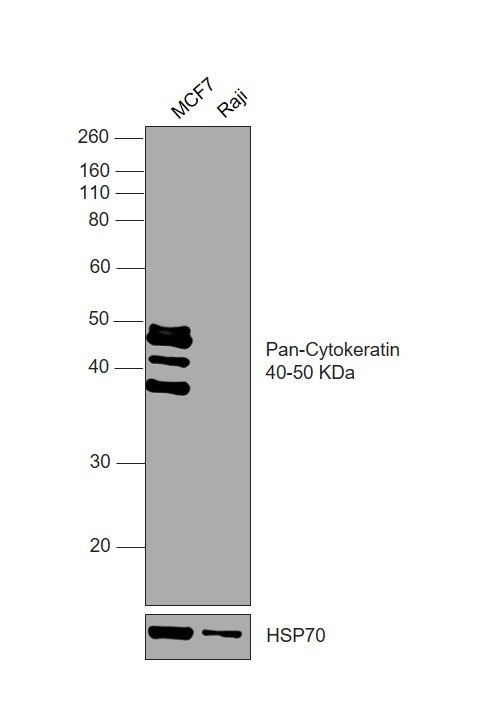 Cytokeratin Pan Antibody