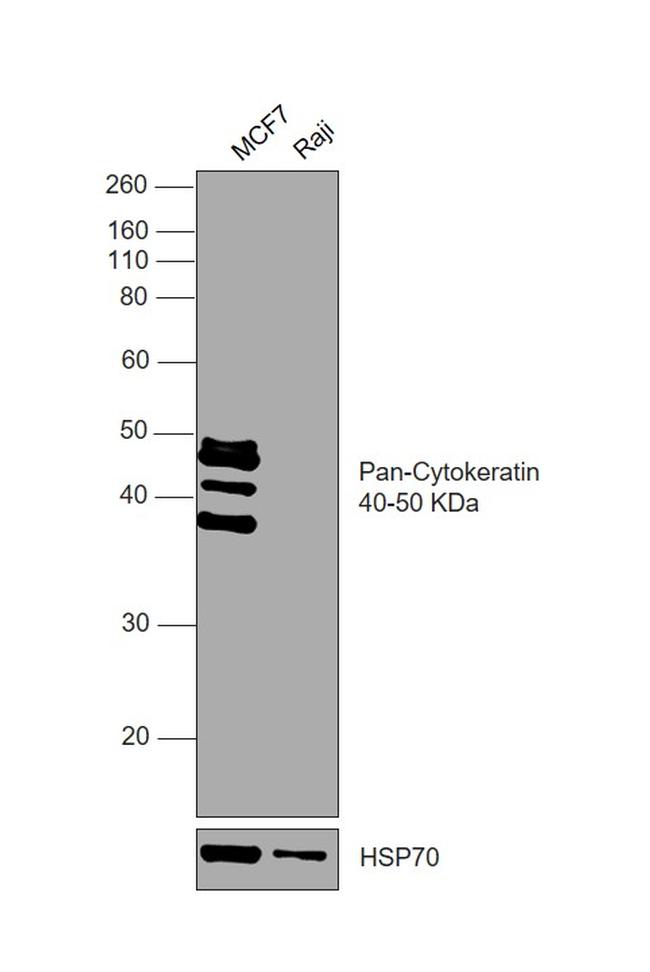 Cytokeratin Pan Antibody in Western Blot (WB)