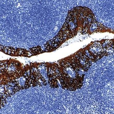 Cytokeratin Pan Antibody in Immunohistochemistry (Paraffin) (IHC (P))