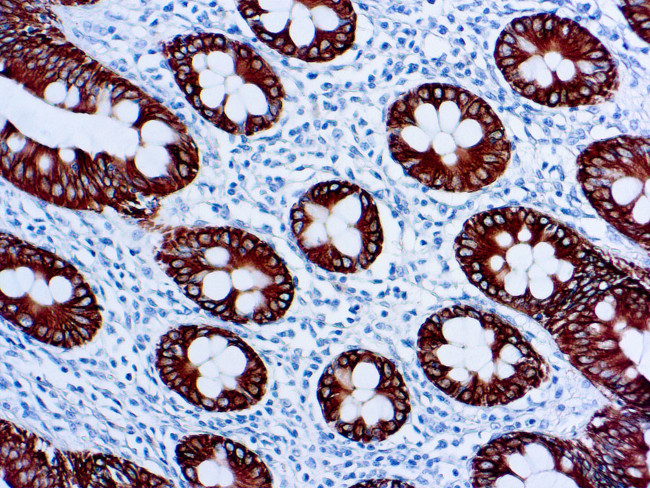 Cytokeratin 8 Antibody in Immunohistochemistry (Paraffin) (IHC (P))