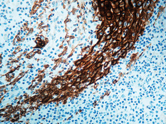 Cytokeratin Pan Type I Antibody in Immunohistochemistry (Paraffin) (IHC (P))