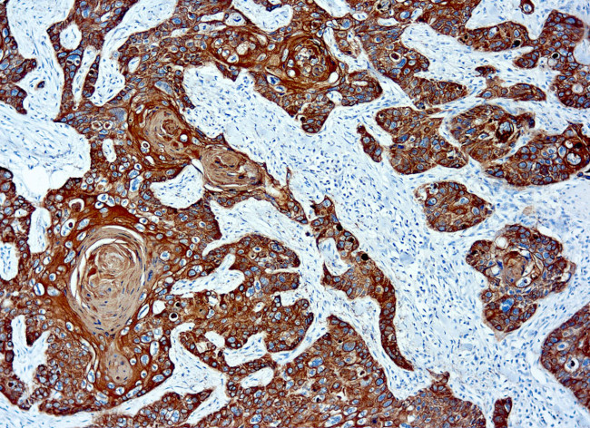 Cytokeratin Pan Type II Antibody in Immunohistochemistry (Paraffin) (IHC (P))