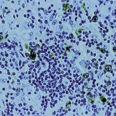 CD30 Antibody in Immunohistochemistry (Paraffin) (IHC (P))