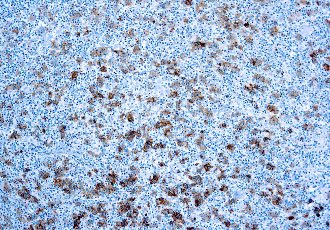 CD30 Antibody in Immunohistochemistry (Paraffin) (IHC (P))