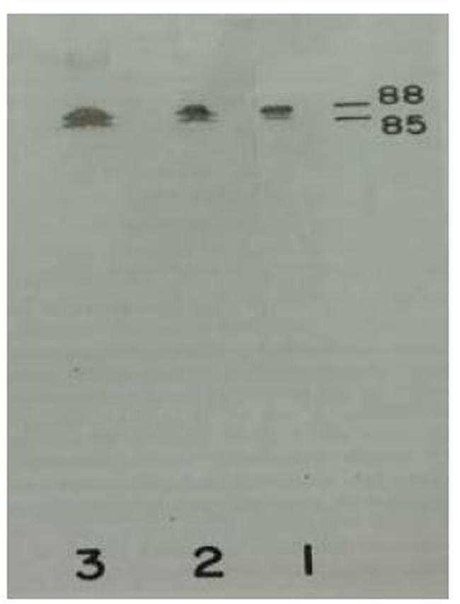 Plasma Kallikrein Antibody in Western Blot (WB)